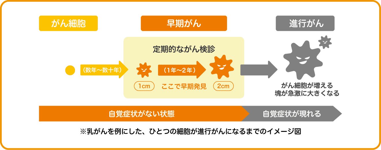 乳がんを例にした、ひとつの細胞が進⾏がんになるまでのイメージ図