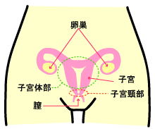 『子宮頸がん』ってなに？
