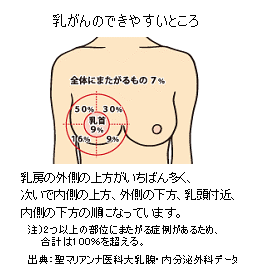 乳がんの自己検診法